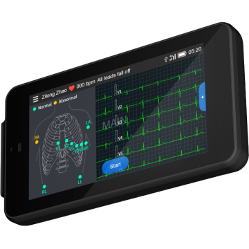 Electrocardiographe de poche Pocket ECG 500 Lepu Médical avec interprétation
