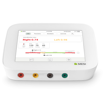 Dispositif de mesure de l’IPS - MESI ABPI MD