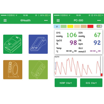 Moniteur patient multiparamétrique GIMA PC-300 (PNI, SpO2,Temp.,Poul) avec ou sans ECG)