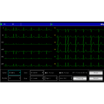 Electrocardiographe ECG Contec 600G (6 pistes) avec interprétation