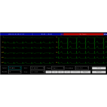 Electrocardiographe ECG Contec 600G (6 pistes) avec interprétation