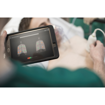Dispositif d’échographie Philips Lumify pour iOS