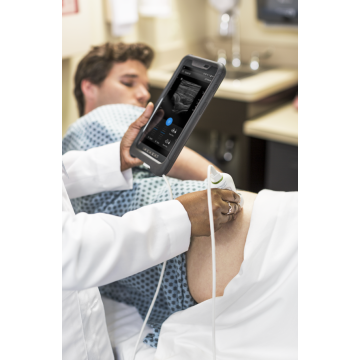 Dispositif d’échographie Philips Lumify pour iOS