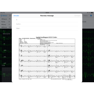 Electrocardiographe ECG Edan PADECG Numérique sans fil pour iPad avec interprétation