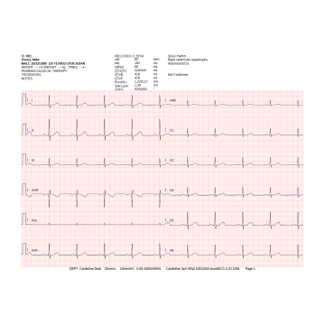 Electrocardiographe ECG Cardioline Touchecg  HD+ Bluetooth (12 pistes) pour PC ou tablette Windows